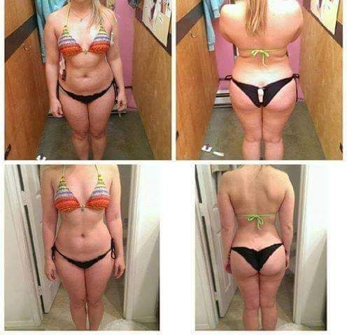 MAUI SPA LASER CENTER - masaje reductivo