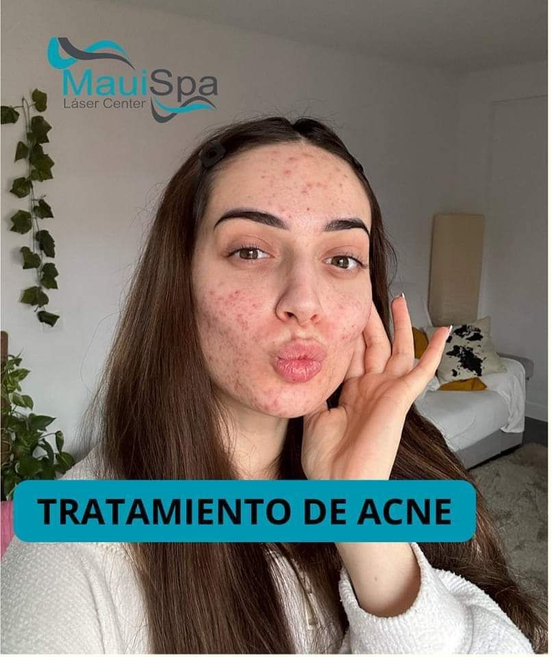MAUI SPA LASER CENTER - tratamiento facial