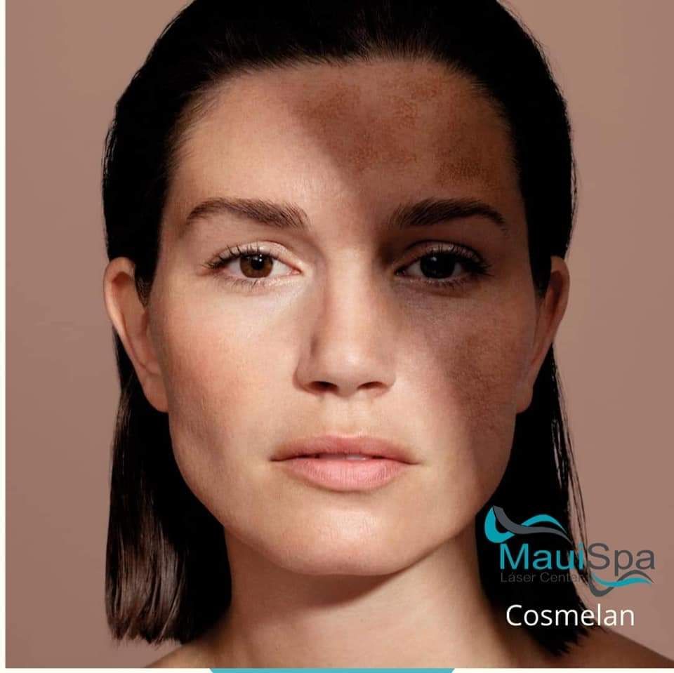 MAUI SPA LASER CENTER - cuidado personal