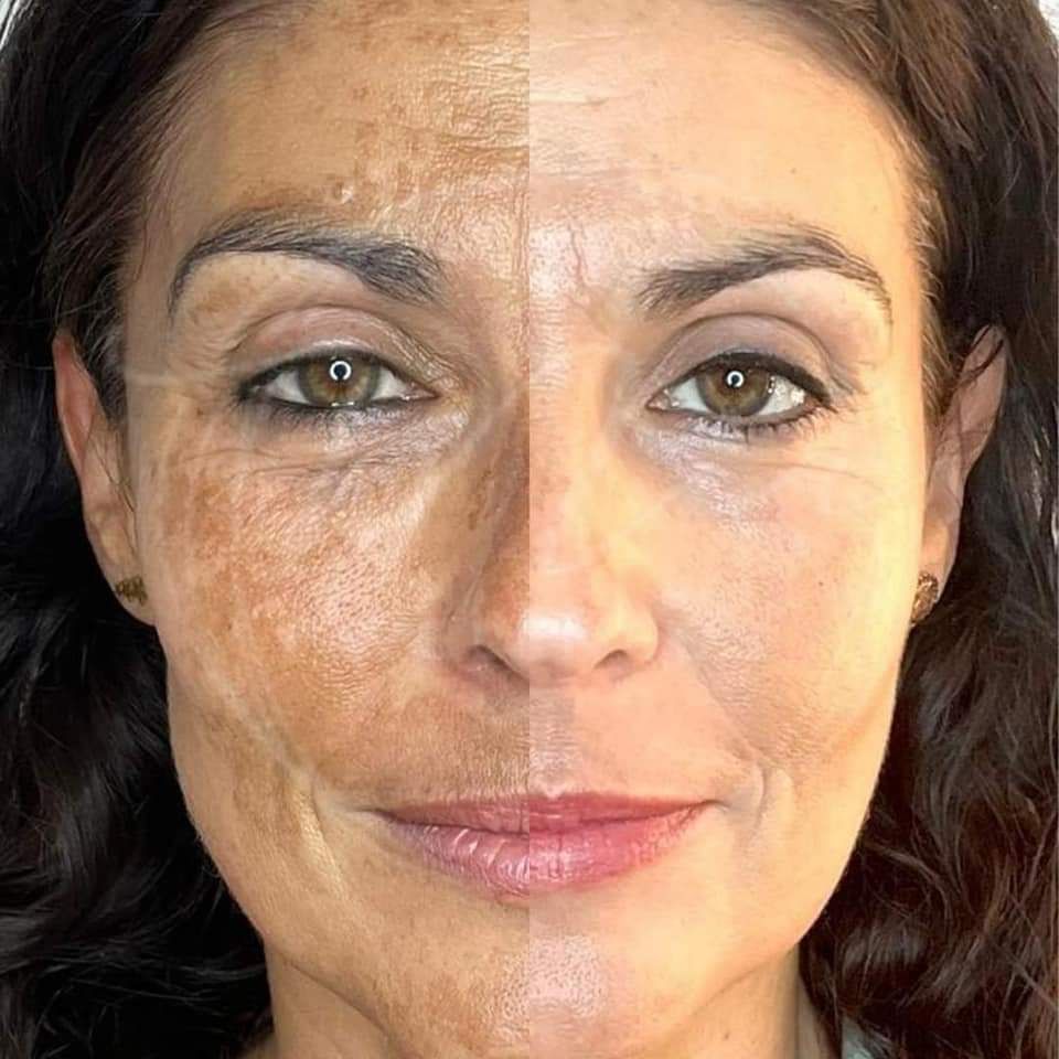 MAUI SPA LASER CENTER