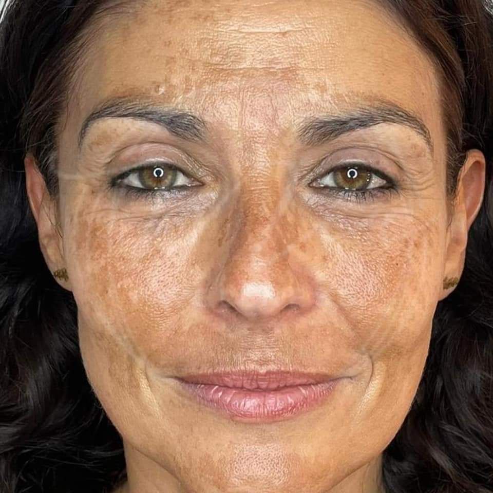 MAUI SPA LASER CENTER