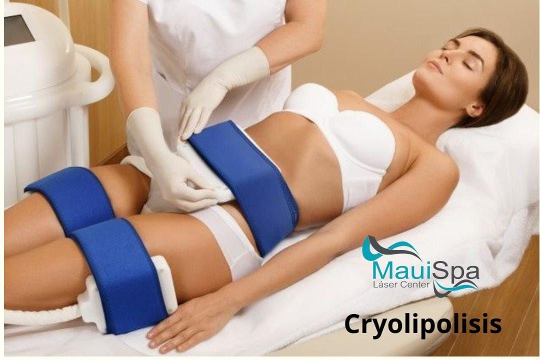 MAUI SPA LASER CENTER - cryolipolisis