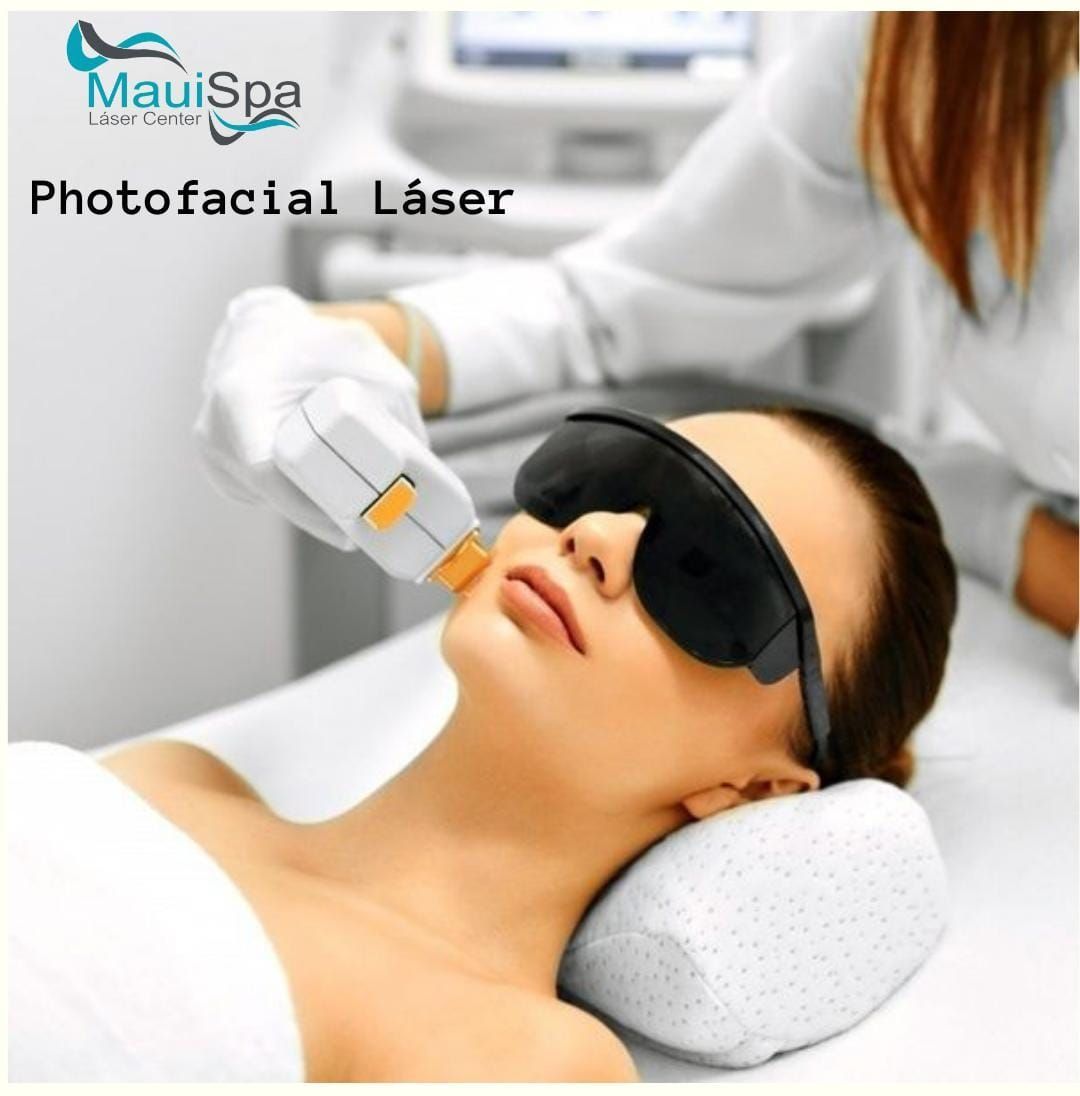MAUI SPA LASER CENTER - foto facial láser