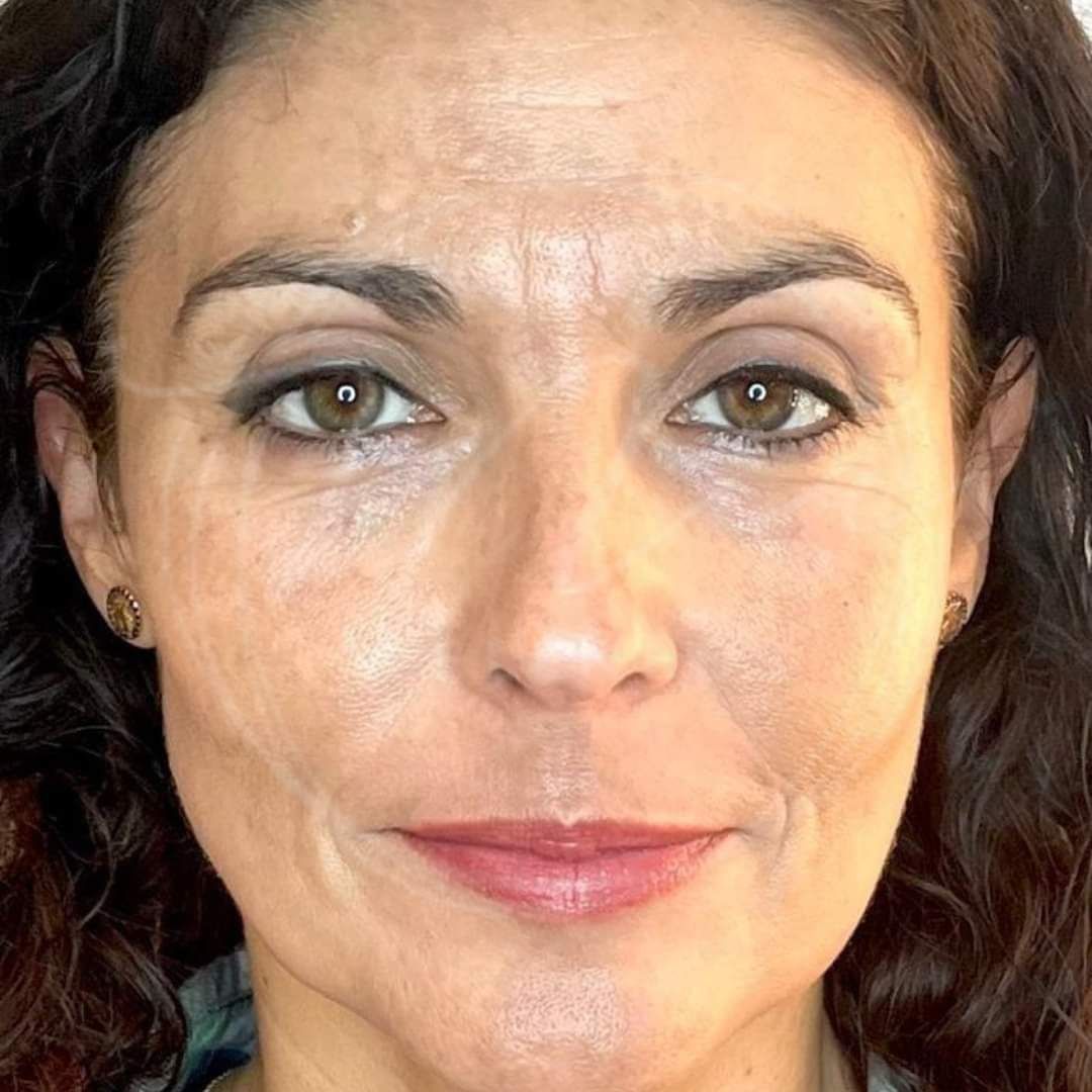 MAUI SPA LASER CENTER