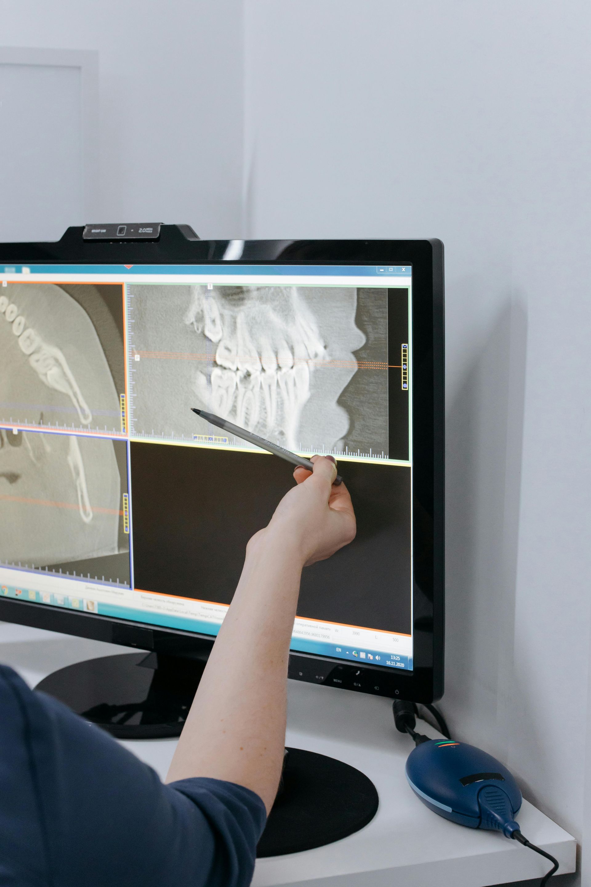 Person pointing at a dental X-ray on a computer screen in a dentist's office.