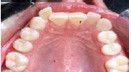 A close up of a person 's mouth with a lot of teeth.