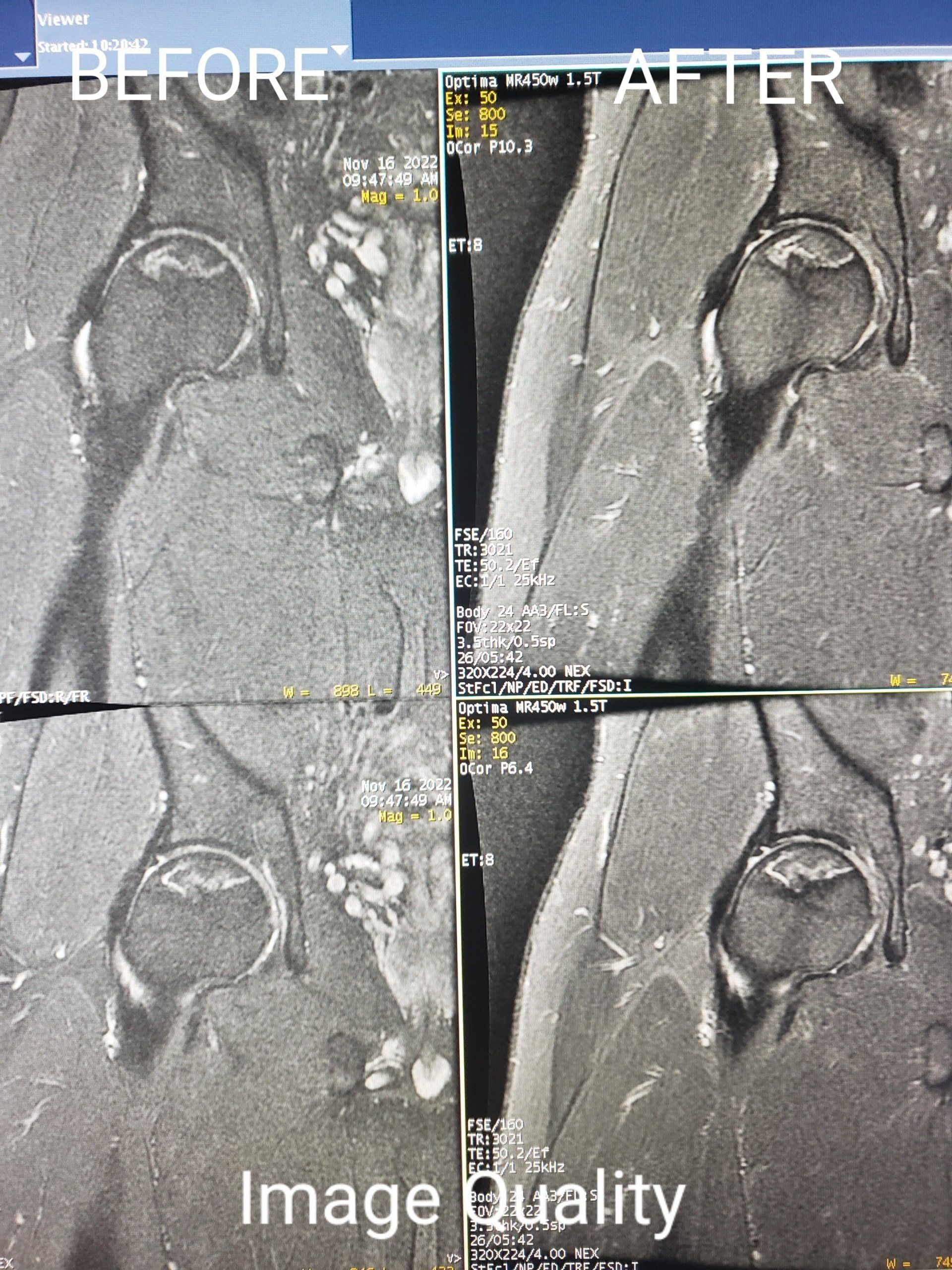 MRI Image — Fairburn, GA — Imaging Diversified