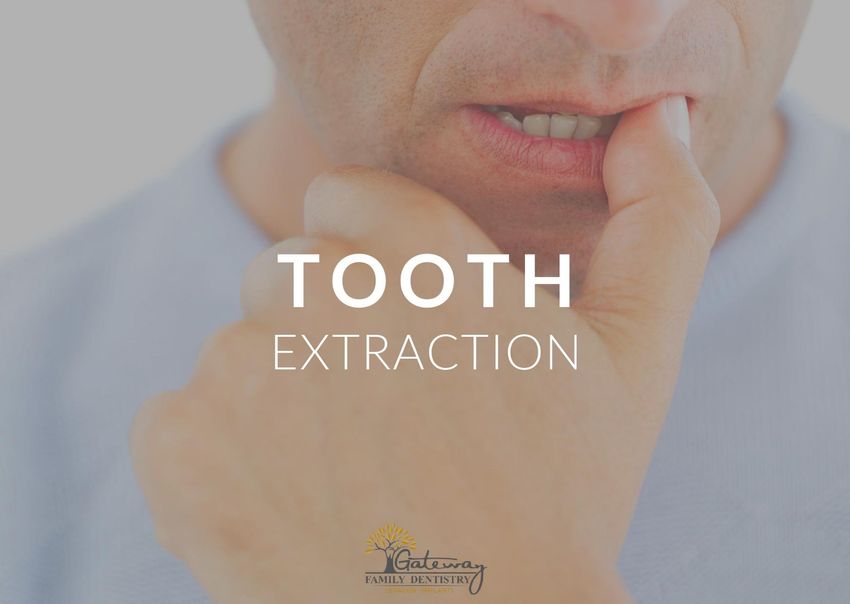 tooth extraction gateway family dentistry