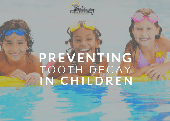 Prevent Tooth Decay in Children Gateway Family Dentistry Prevent Tooth Decay in Children Gateway Family Dentistry