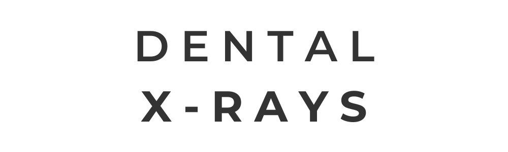 Dental Sealants at Gateway Family Dentistry