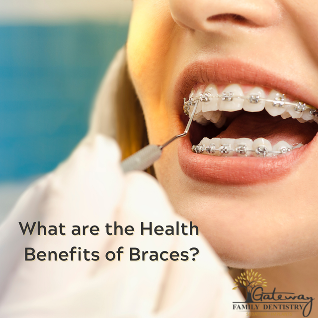 How Can Orthodontic Treatment Help You?