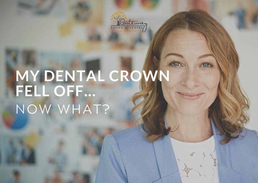 Dental Crown Fell Off Gateway Family Dentistry Murfreesboro