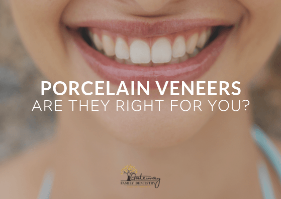Porcelain Veneers Gateway Family Dentistry