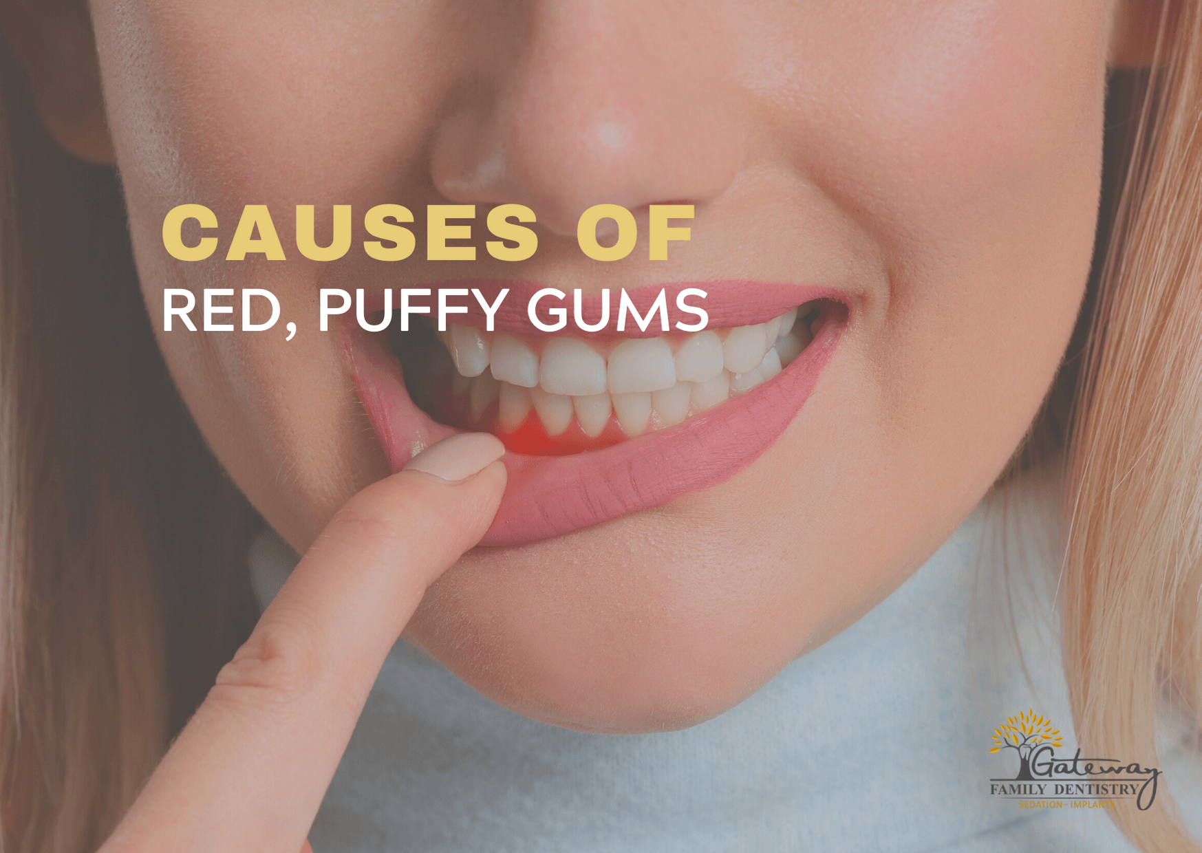 Causes of Red Gums