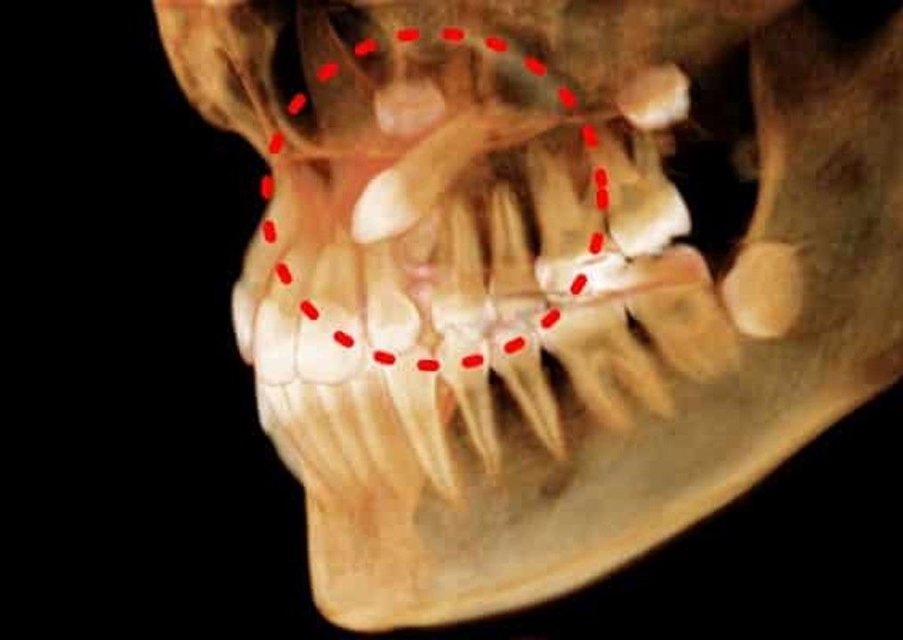 DRA. ARIANA MORENO CIRUGÍA BUCAL E IMPLANTOLOGÍA