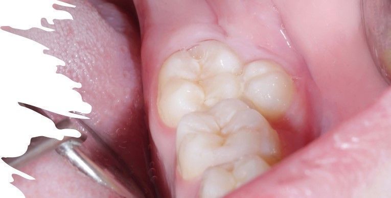 DRA. ARIANA MORENO CIRUGÍA BUCAL E IMPLANTOLOGÍA