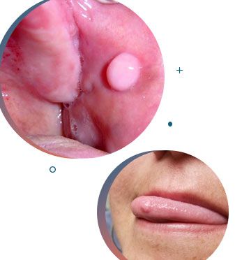 DRA. ARIANA MORENO CIRUGÍA BUCAL E IMPLANTOLOGÍA