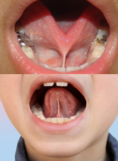 DRA. ARIANA MORENO CIRUGÍA BUCAL E IMPLANTOLOGÍA