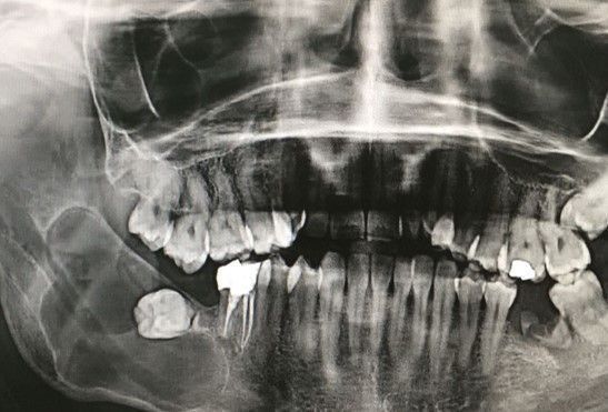 DRA. ARIANA MORENO CIRUGÍA BUCAL E IMPLANTOLOGÍA