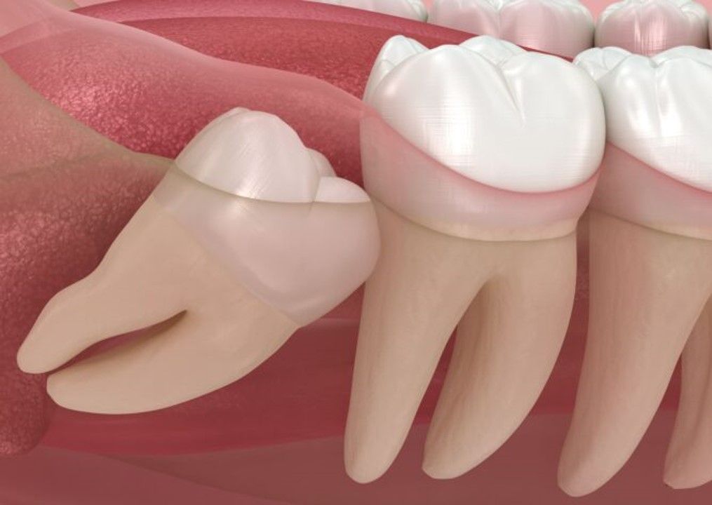 DRA. ARIANA MORENO CIRUGÍA BUCAL E IMPLANTOLOGÍA