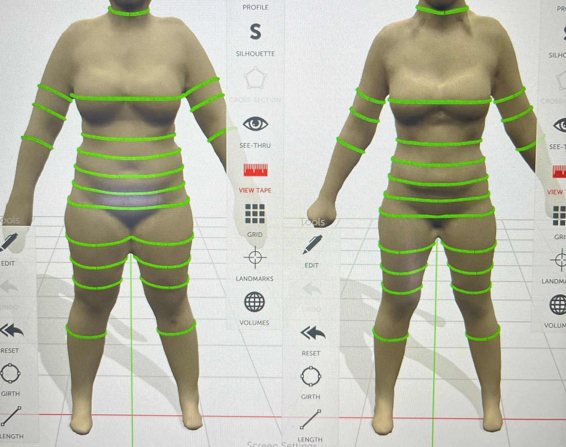 Full body scanning weight loss