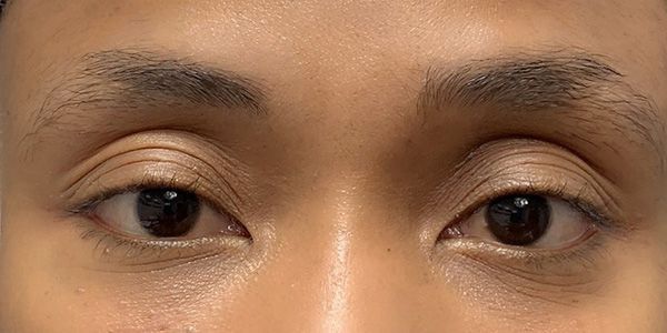 A close up of a person 's eyes without makeup.