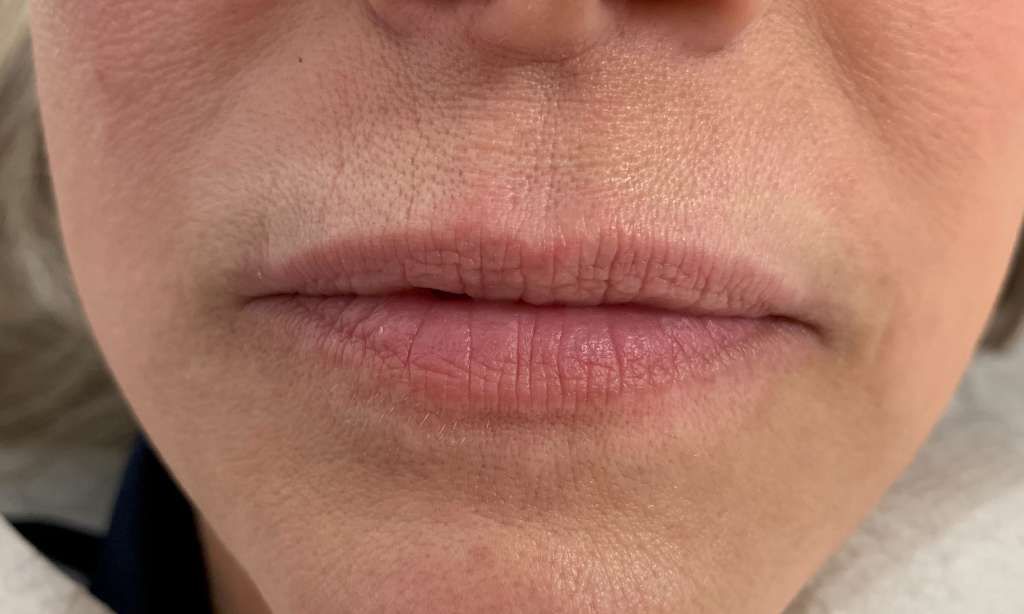 A close up of a woman 's lips with wrinkles.