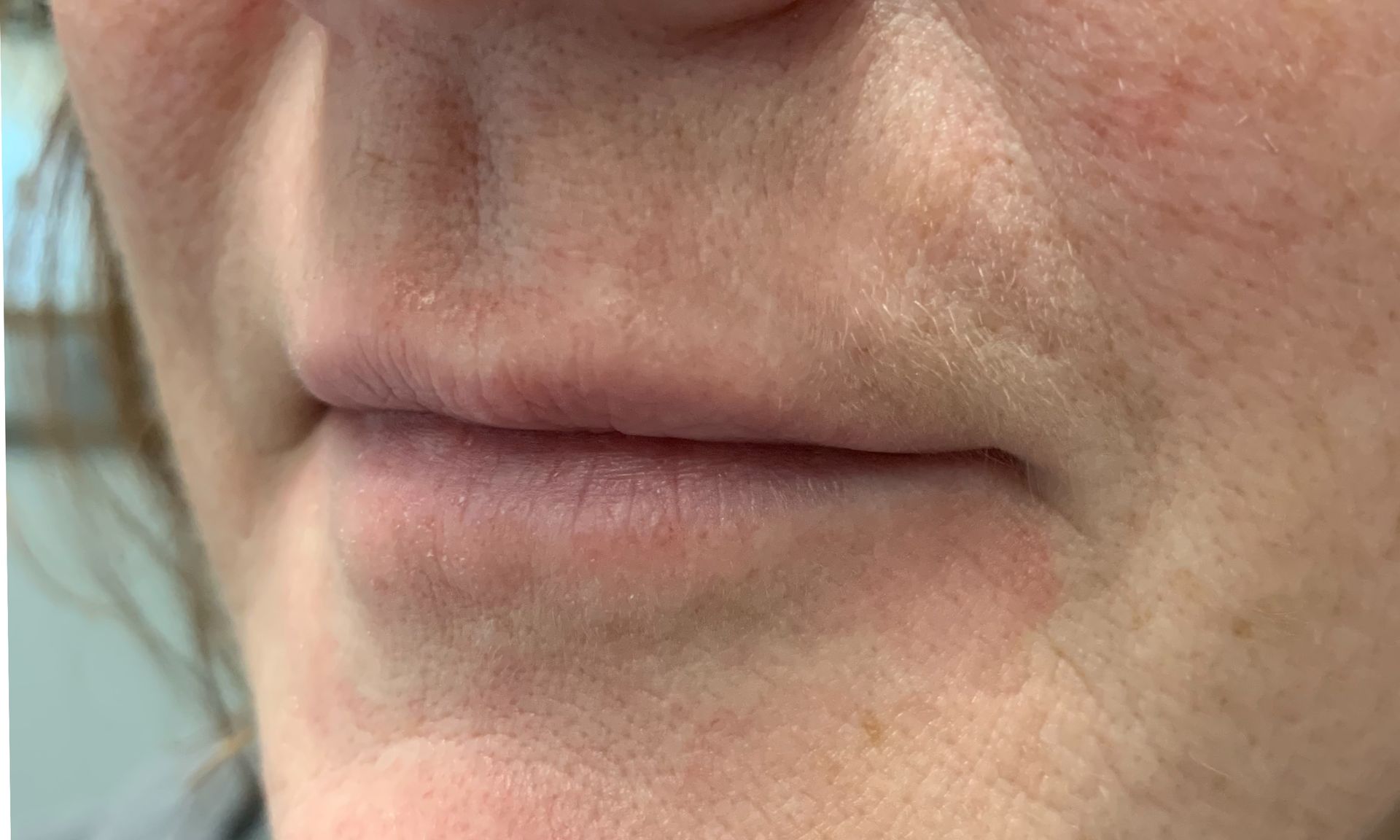 A close up of a woman 's lips and nose.