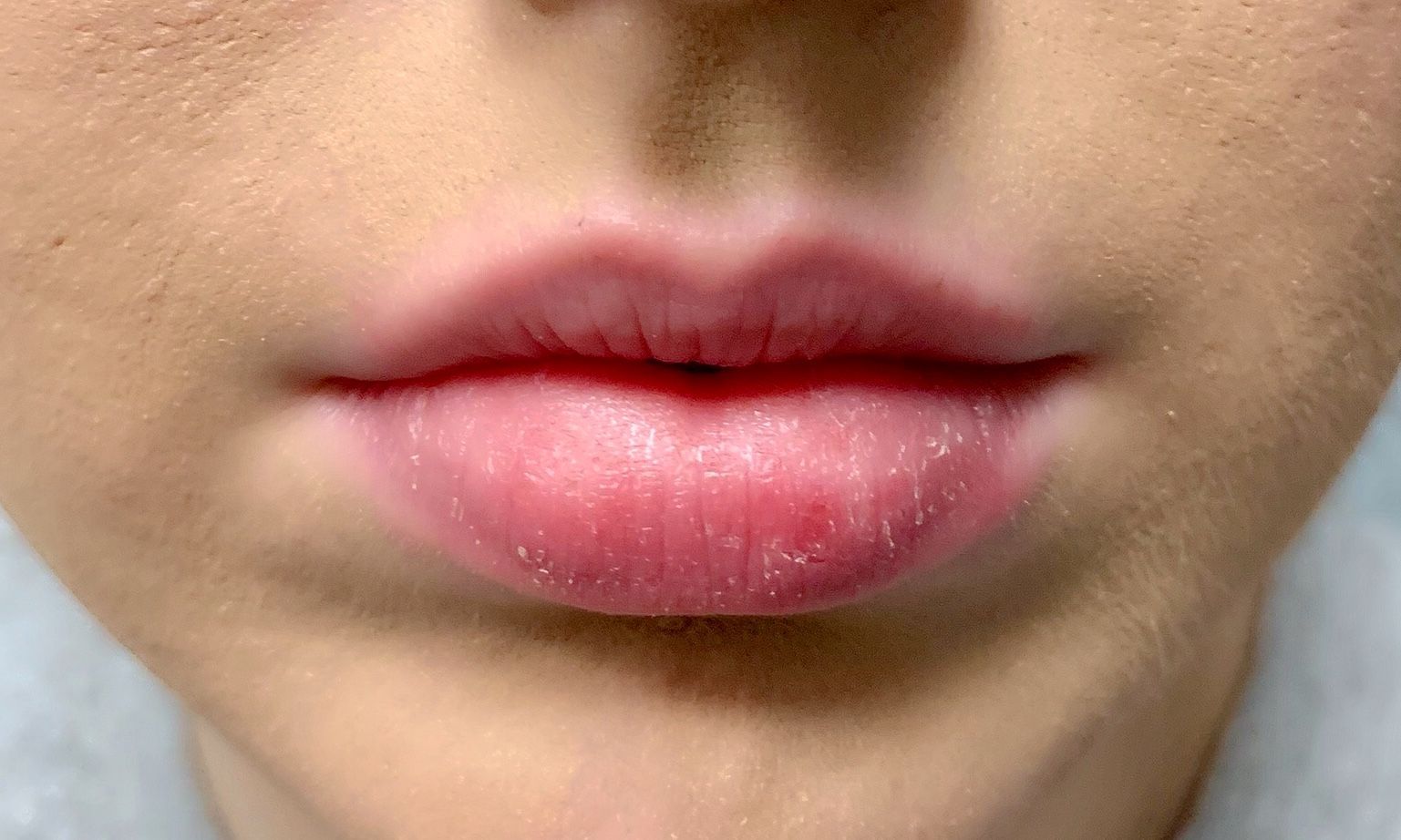 A close up of a woman 's lips with a few white spots on them.