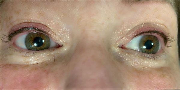 A close up of a woman 's eyes with a red eye.