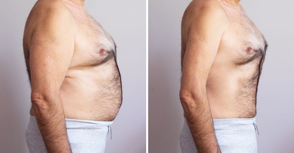 A man is shown before and after losing weight.