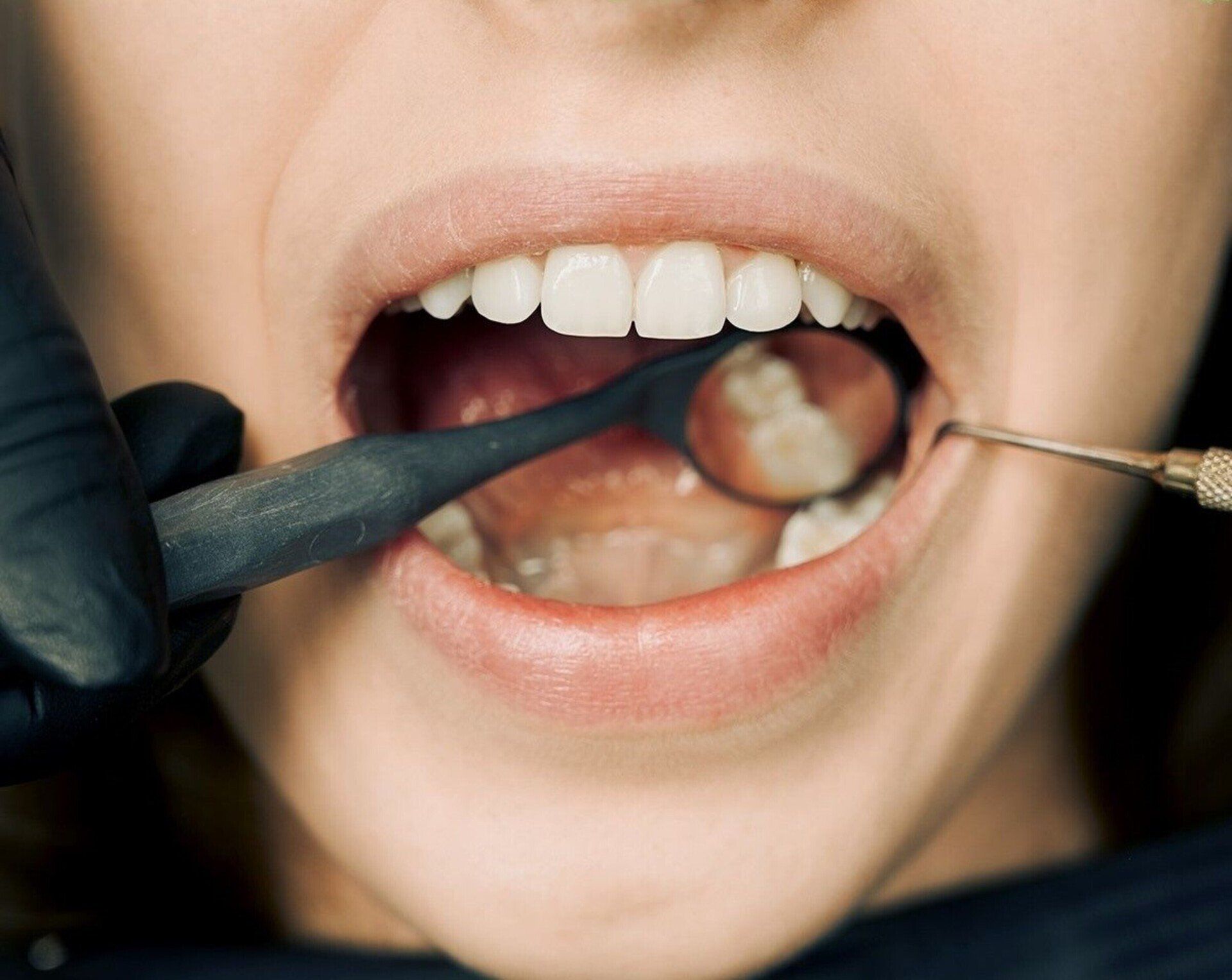 woman with mouth open at dentist