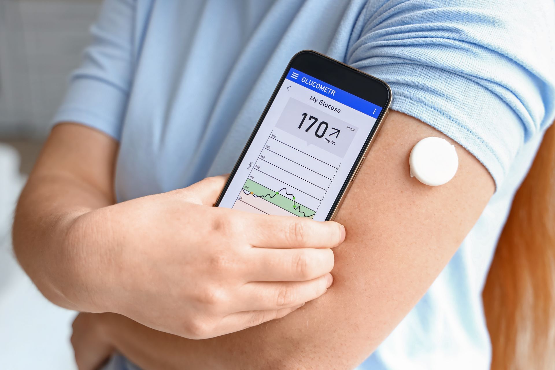 Woman's arm with a glucose sensor and smartphone displaying blood sugar level of 170.