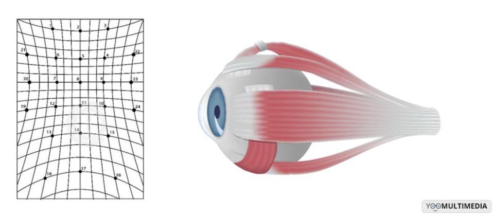 schermo di Hess-Lancaster
