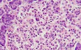 CENTRO DE ANATOMÍA PATOLÓGICA CITOLOGÍA EXFOLIATIVA COLPOSCOPIA Y ANDROSCOPIA Dr. Carlos Eduardo Taracena Baron-CÉLULAS