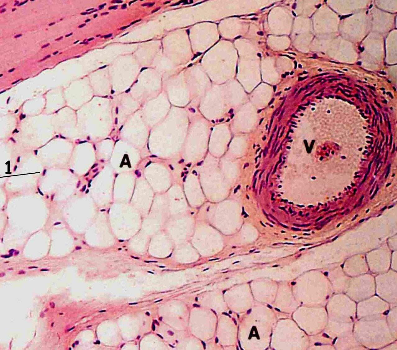 CENTRO DE ANATOMÍA PATOLÓGICA CITOLOGÍA EXFOLIATIVA COLPOSCOPIA Y ANDROSCOPIA Dr. Carlos Eduardo Taracena Baron-TEJIDO