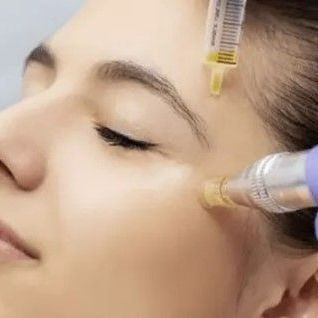 Level 4 Certificate in Skin Needling Treatments RFQ