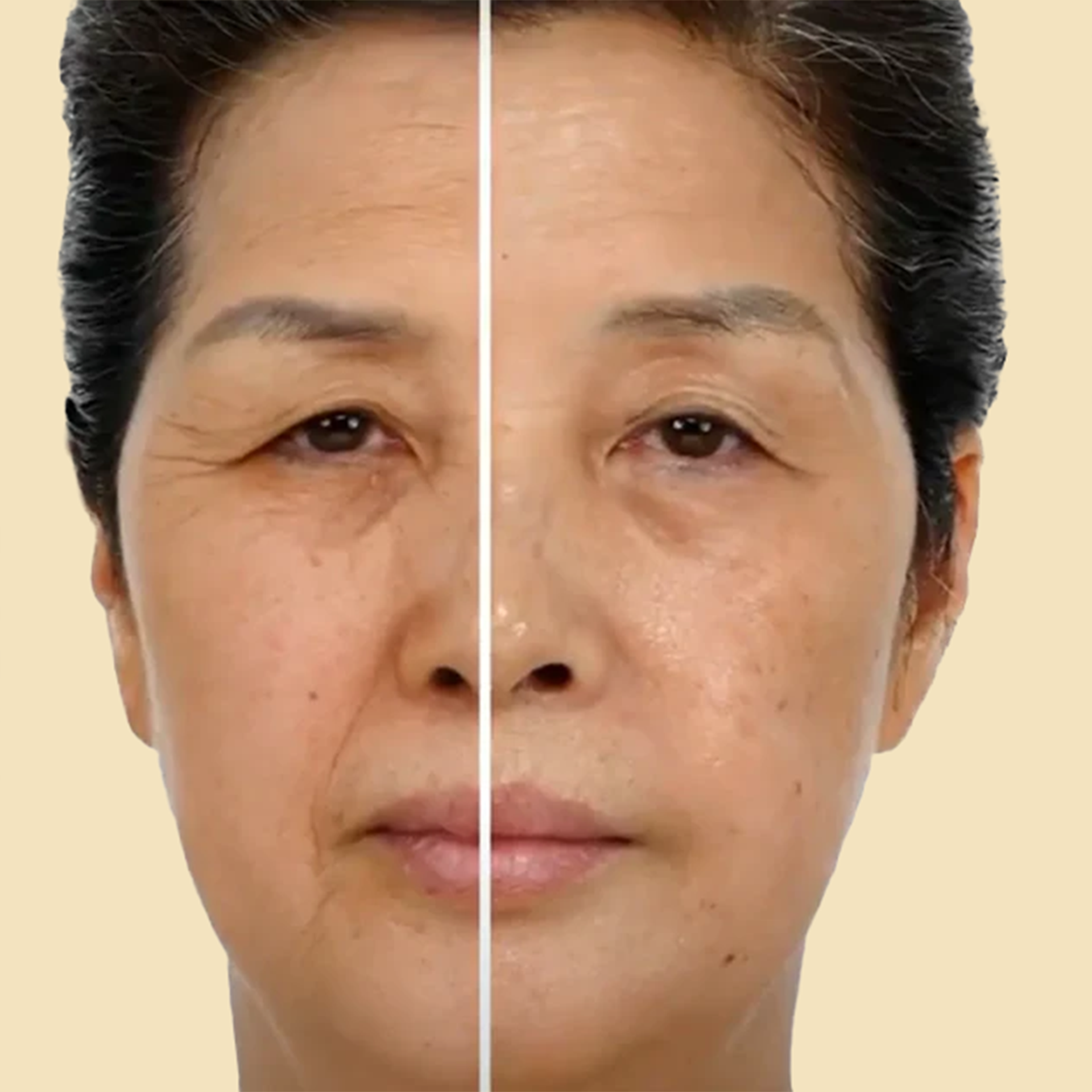 A before and after photo of a woman 's face.