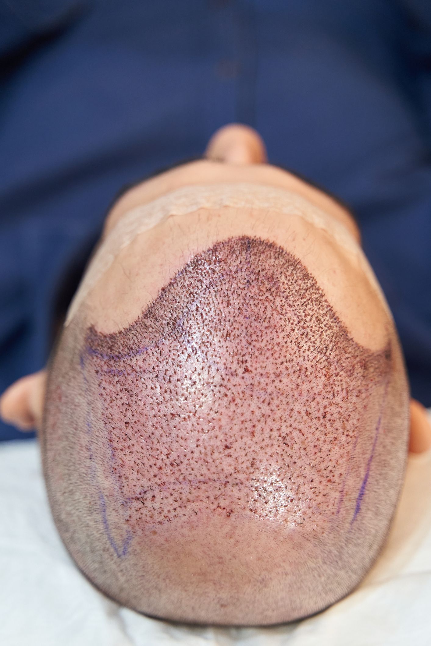 Unik Beauty tratamientos estéticos