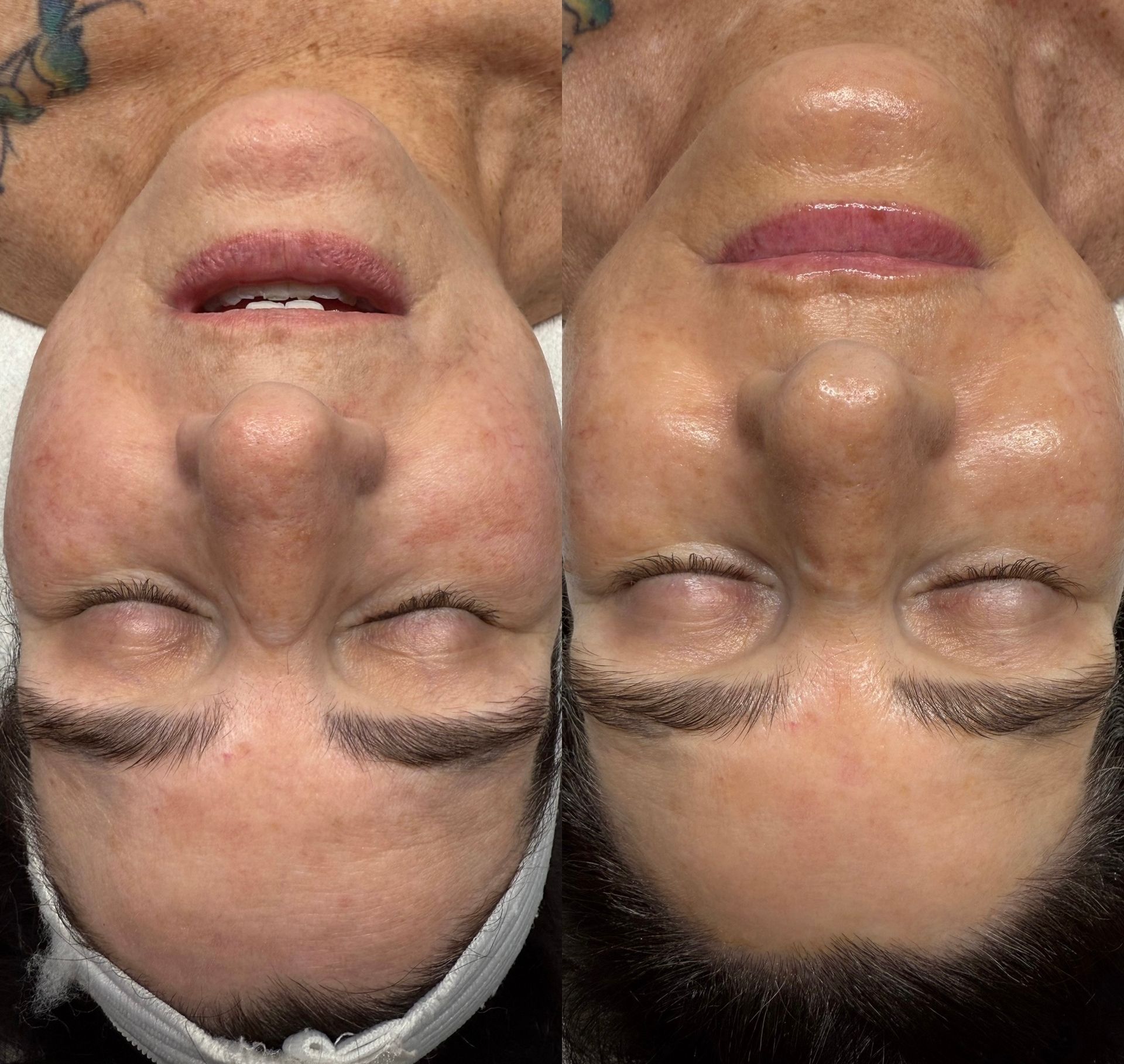 A before and after photo of a woman 's face with her eyes closed.