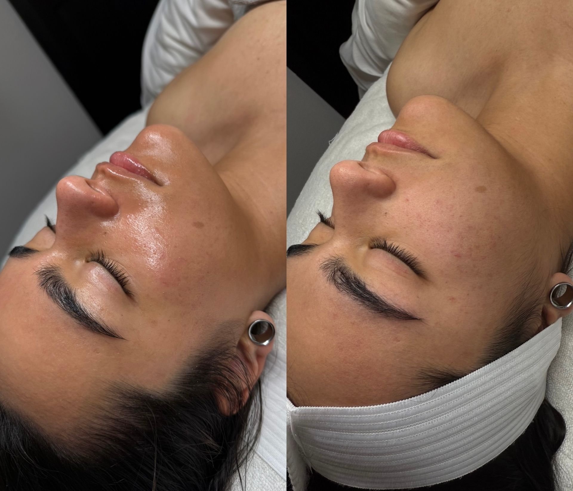 A woman is getting a facial treatment with her eyes closed