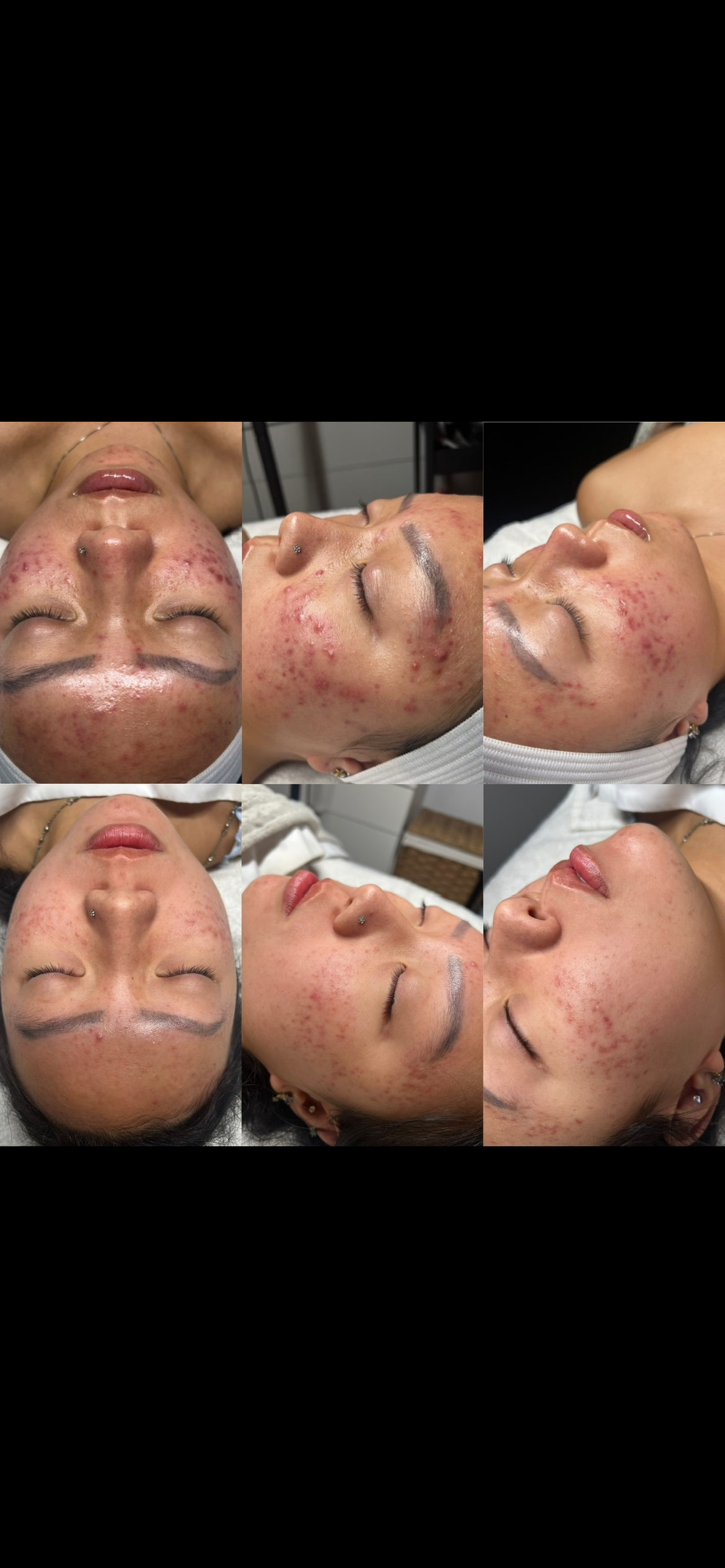 A woman is getting a facial treatment at a beauty salon.