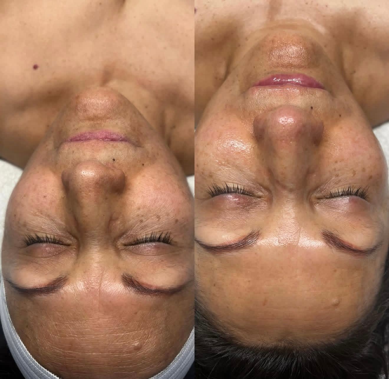 A before and after picture of a woman 's face with her eyes closed.