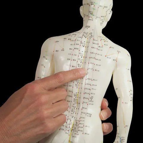 Acupuncture Treatments — St. Peters, MO — Mid Rivers Chiropractic