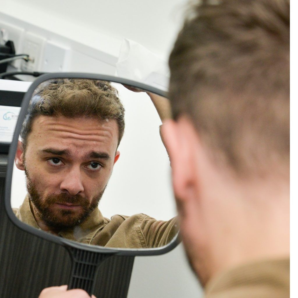 Jack P. Shepherd has reportedly revealed his third hair transplant. Here’s what his transformation s