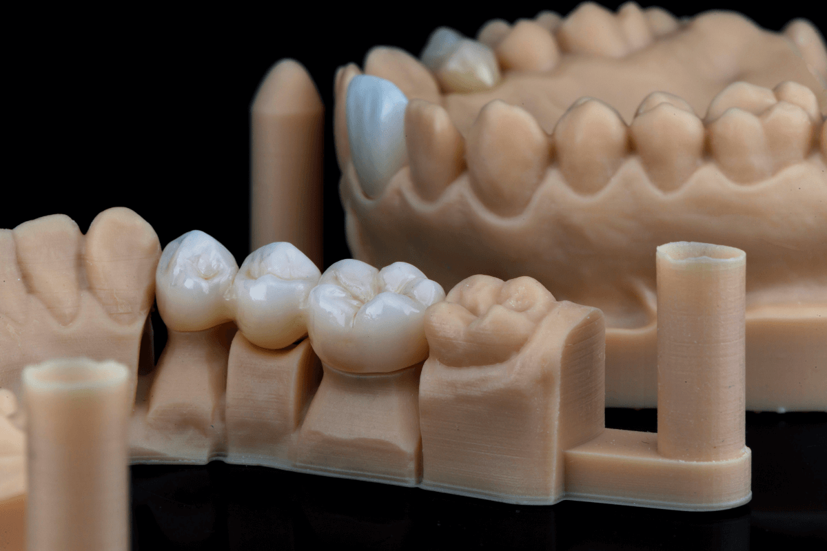 Tooth Removal | Aurora, IL | Prairie Point Dental