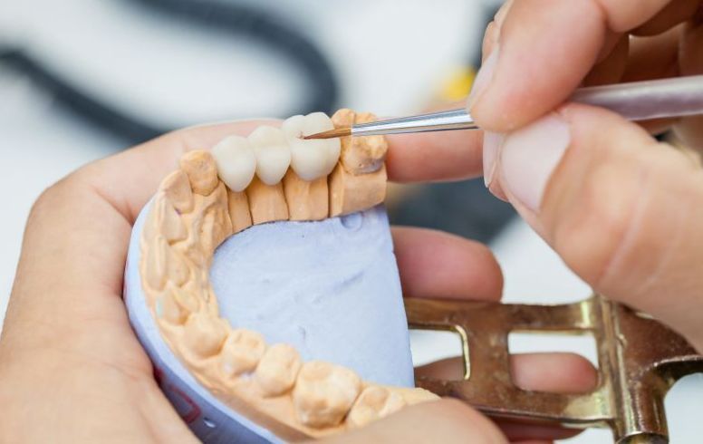 Dental Bridge | Aurora, IL | Prairie Point Dental