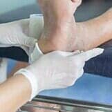 Infected Wound of Diabetic — Diabetic Foot Care in Chicago, IL