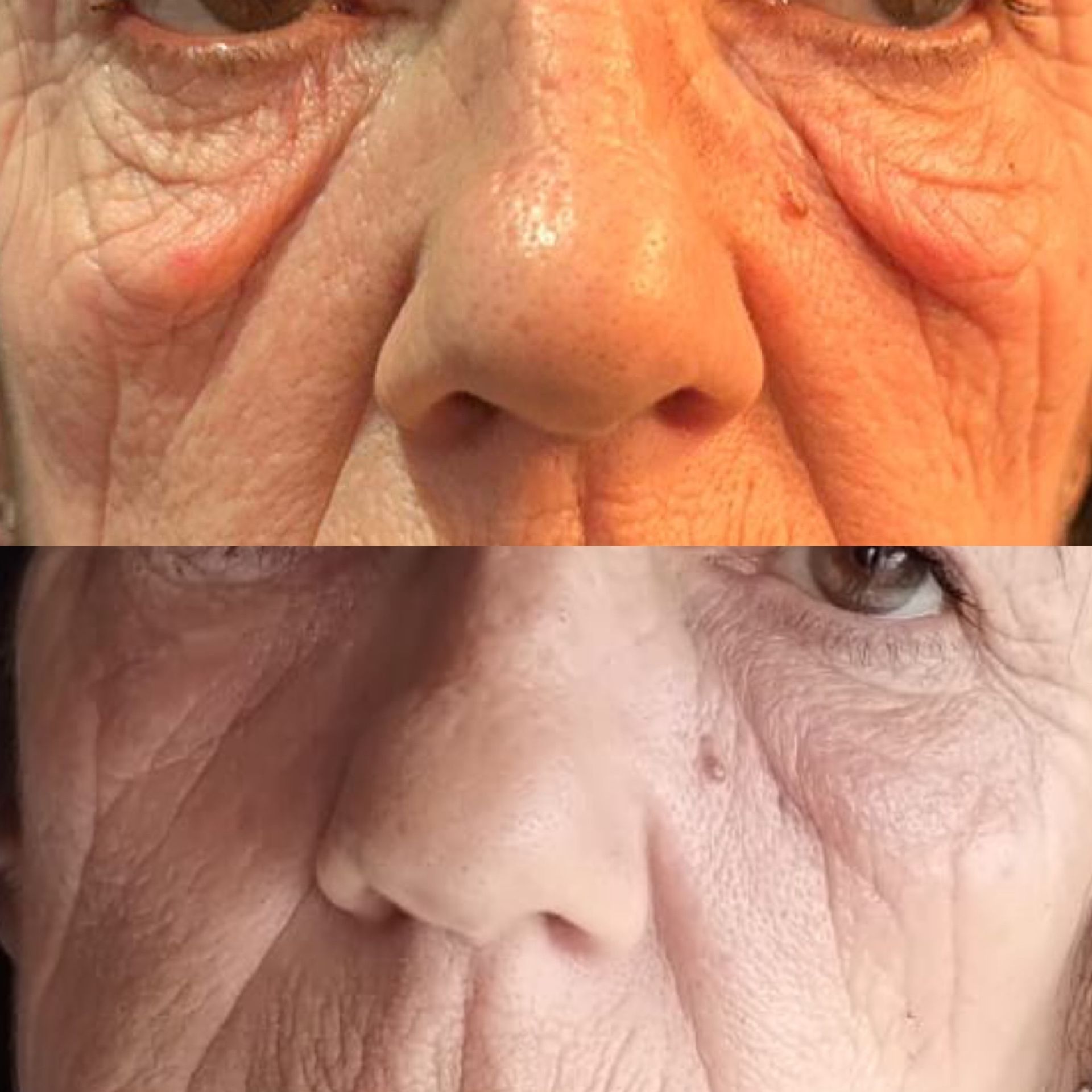 woman's face half with makeup half without