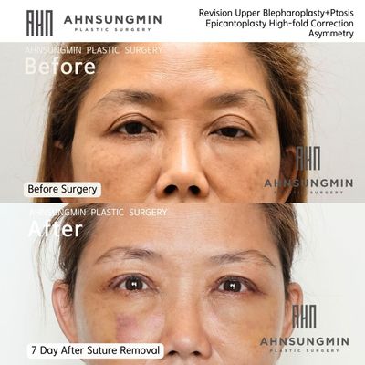AHN's aesthetic surgery & dermatology